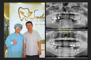 Chính sách bảo hành tại nha khoa My Smile Đà Nẵng