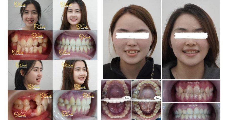Khách hàng sau khi trải nghiệm dịch vụ tại My Smile