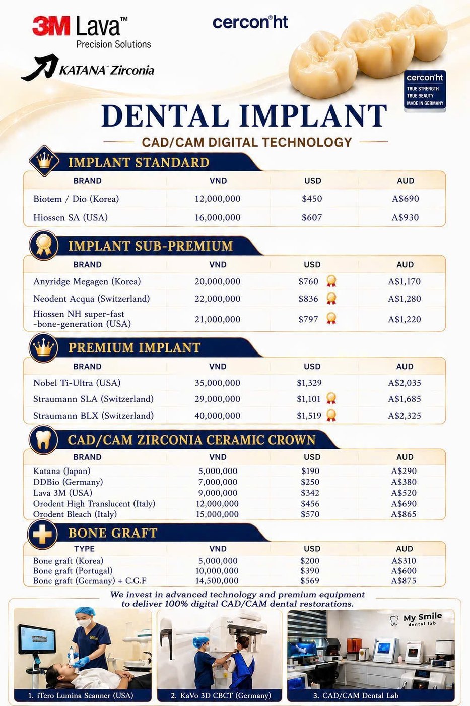 Dental implant price list at My Smile Dental Clinic Da Nang