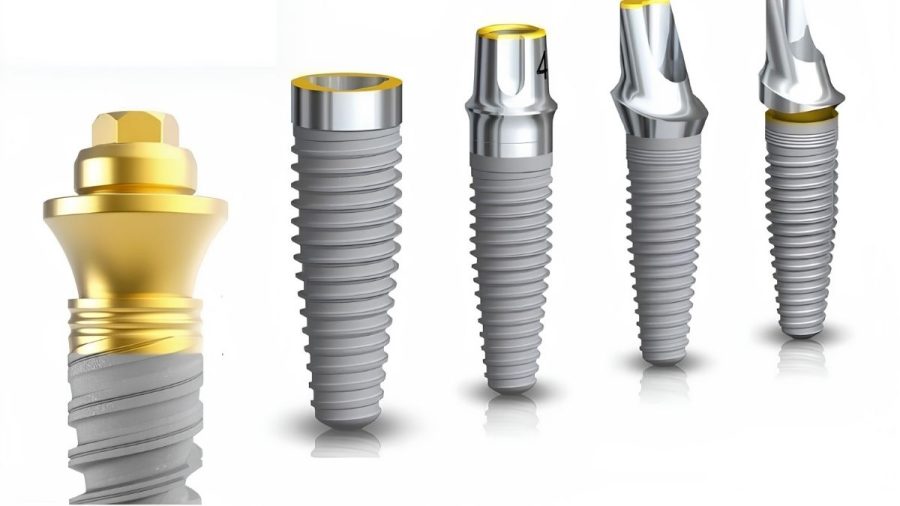 Hệ thống các dòng trụ Implant Nobel Biocare chính hãng với thiết kế đa dạng